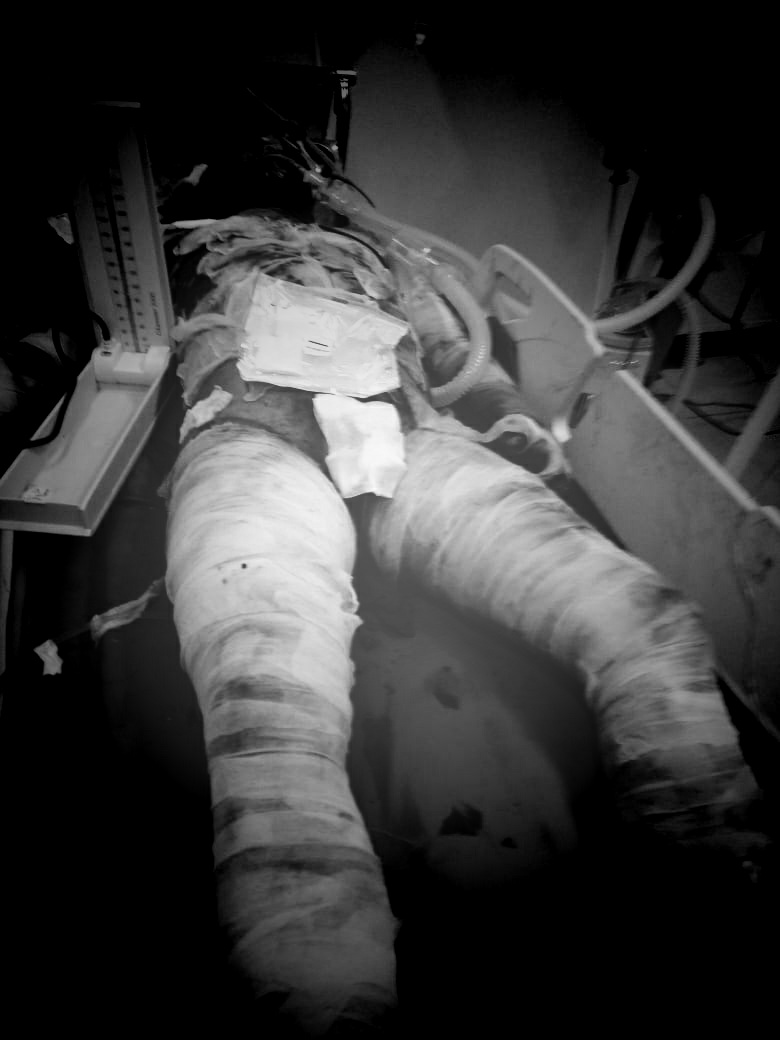 Pelaku Pembakaran Warga di Lapangan Reformasi Tembung di Tangkap