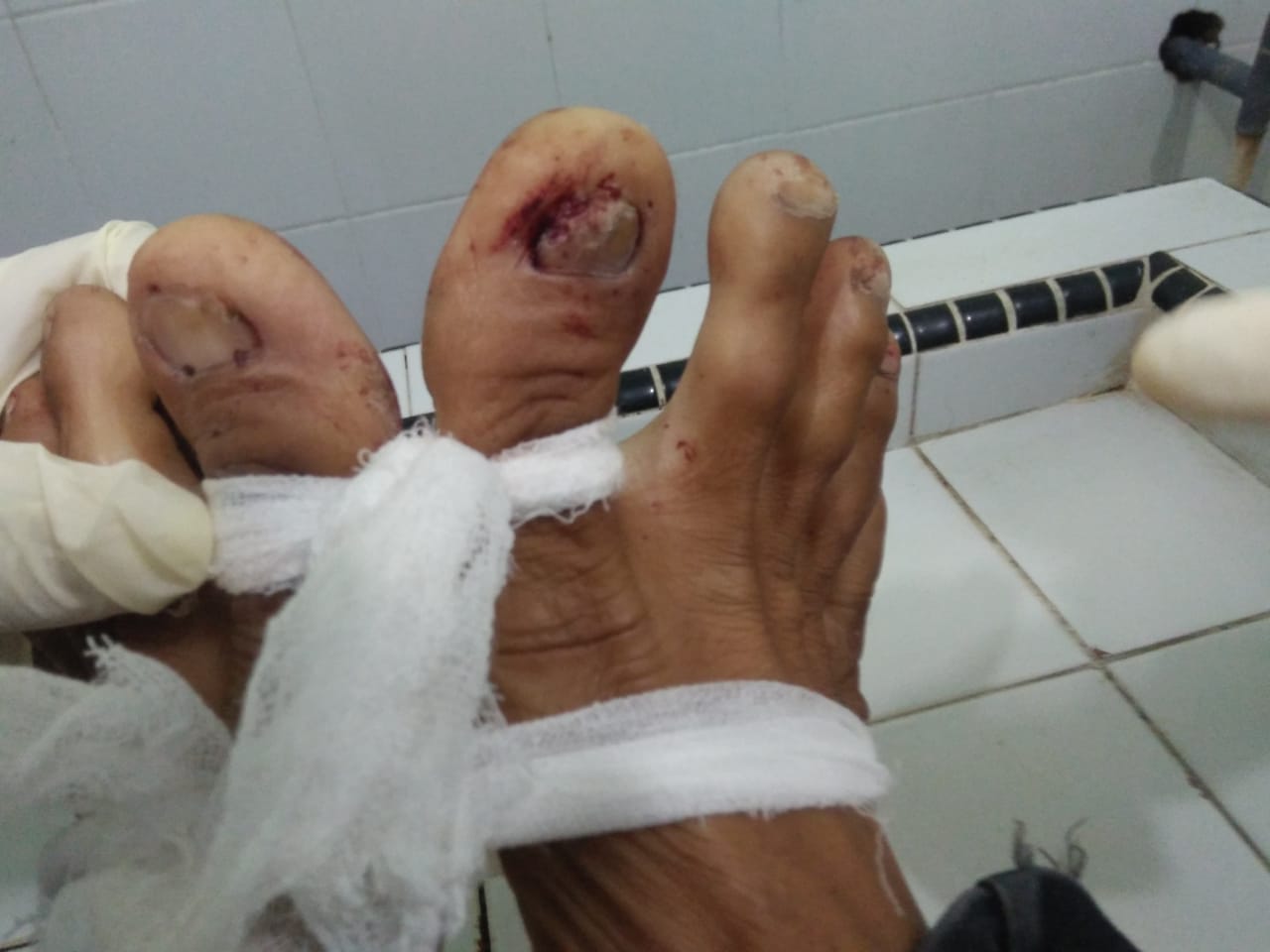 Polisi Kantongi Identitas Pelaku Penembakan Warga