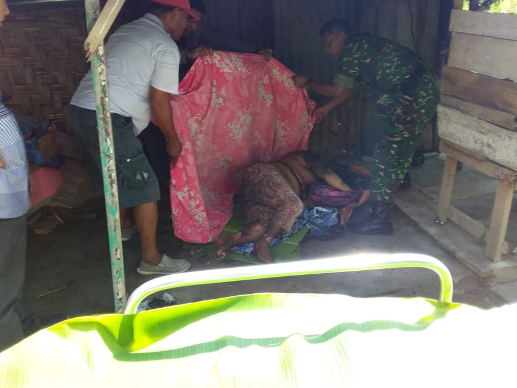 Anak Bakar Ibu Tirinya di Asahan