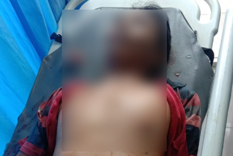 Tewas Ditusuk Pakai Obeng