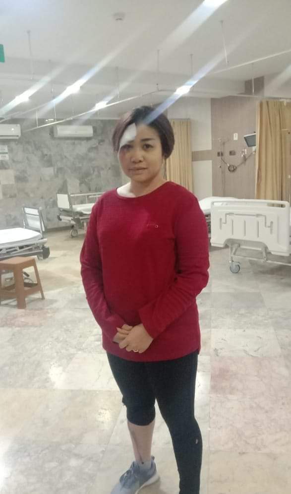 Seputaran Fly Over Amplas Rawan Begal, Seorang Luka Dipelipis Mata, Uang dan Hp Dirampas