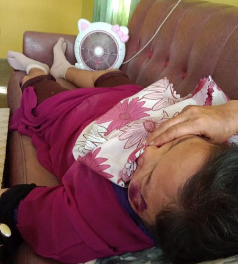 Medan Tak Nyaman, Isteri Redaktur Poskota Ina Luka-luka Dijelambret di Jalan Bilal