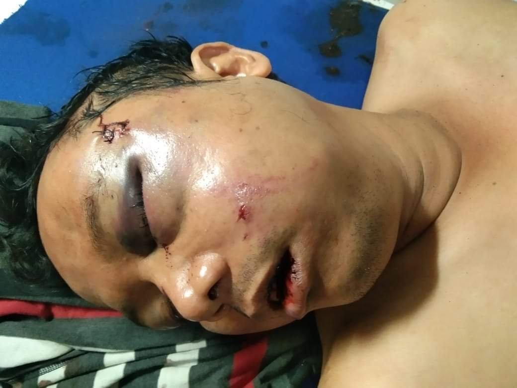 Kurniawan Syahputra Seorang Reporter Ditemukan Kritis Tidak Sadarkan Diri, Sepeda Motor Raib