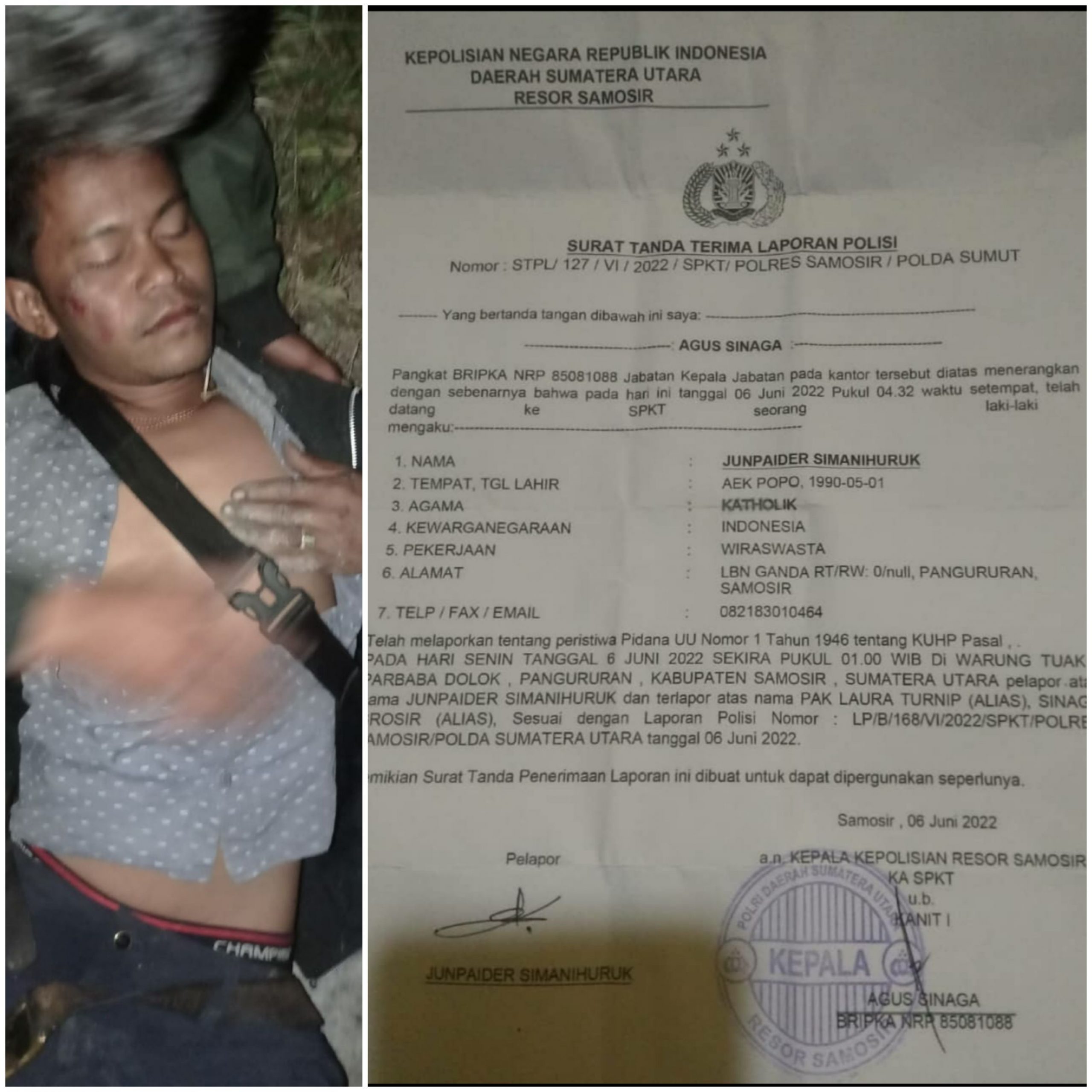 Korban Penganiayaan di Samosir Akan Datangi Propam Polda Sumut