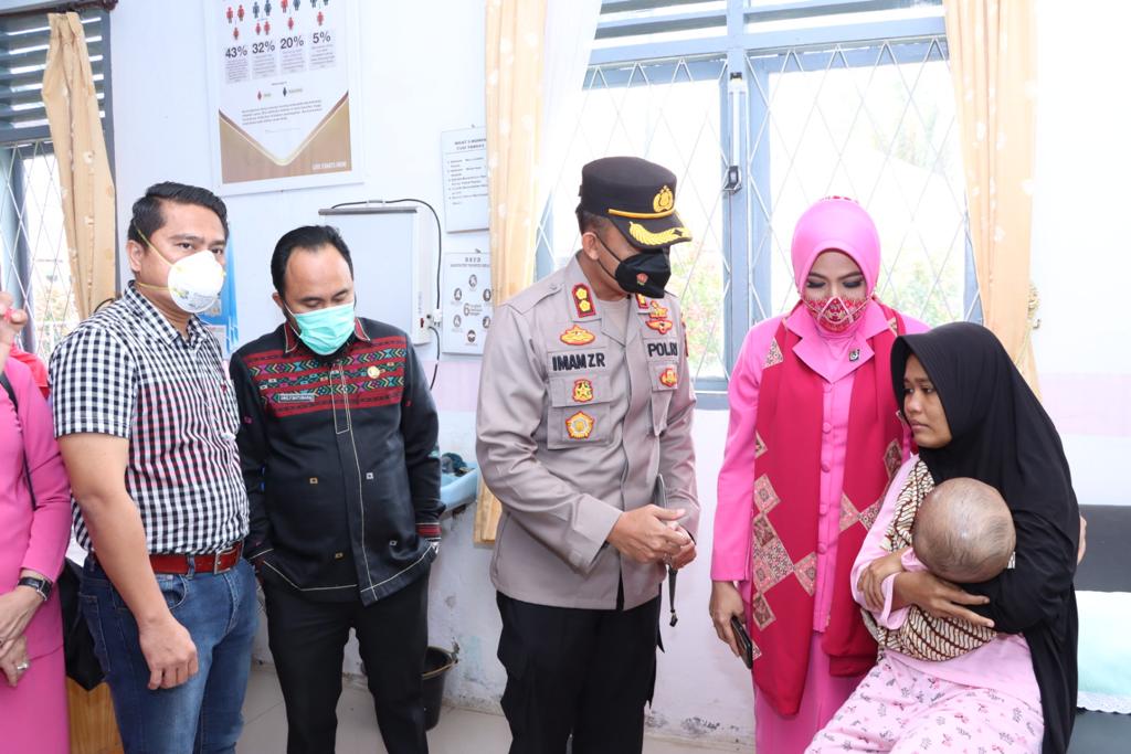Kapolres Tapsel didampingi Ketua Bhayangkari Bersama Jajarannya Jenguk Penderita Hydrocephalus