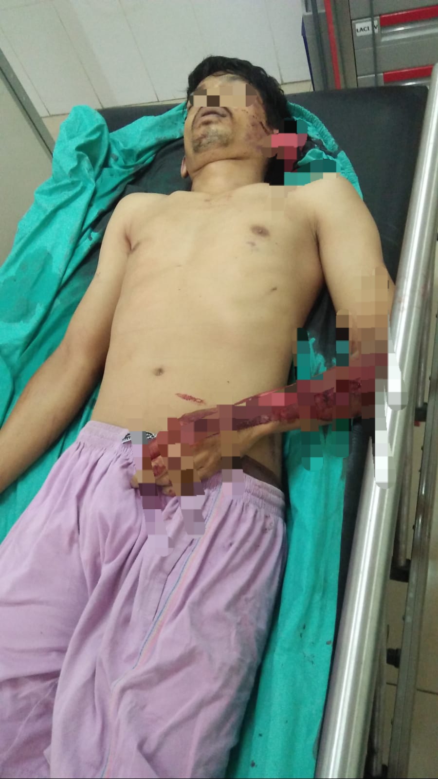 Kecelakaan Beruntun Diperempatan Simpang Waspada Tewaskan Seorang Pengendara Motor