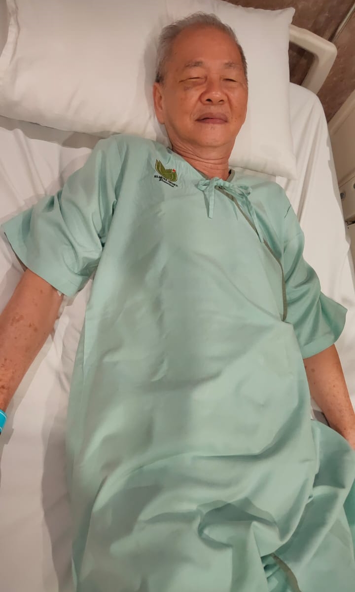 Kakek 69 Tahun Opname Dihantam Helm Rahang Bergeser dan Penglihatan Terganggu