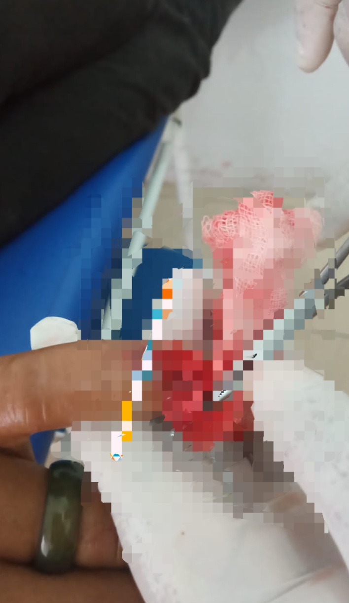 Diduga Beking Proyek Perusahaan, Oknum TNI AD Arogan Aniaya Warga