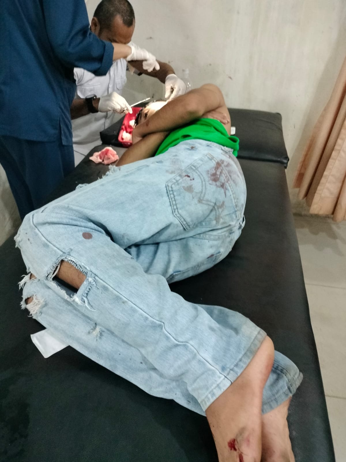 Aksi Brutal Sekelompok Pemuda di Padangsidimpuan, Tusuk Kepala Orang dengan Obeng