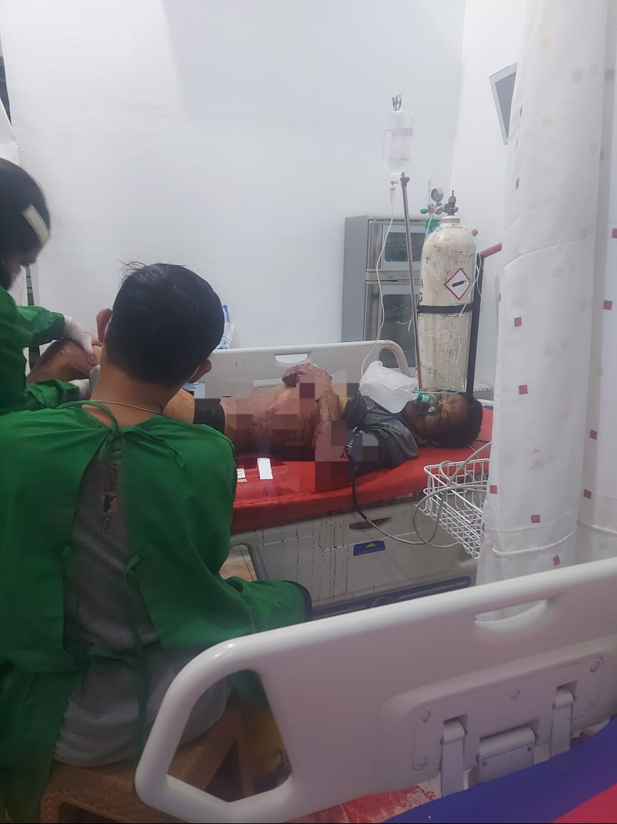 Gegara Ditegur Berbahasa Kotor, Benyamin Bacok Sekjen Satgasus DPC LSM PAKAR Kabupaten Deliserdang