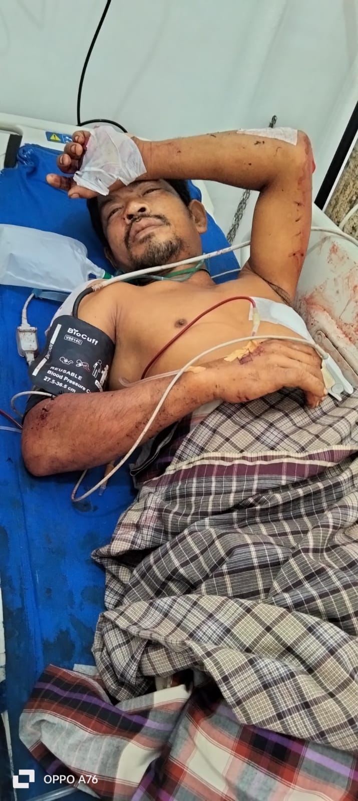 Buntut Pembacokan Jupentus Sitanggang, Gabungan Aliansi Ormas Akan Geruduk Pabrik Bubut Milik Indra