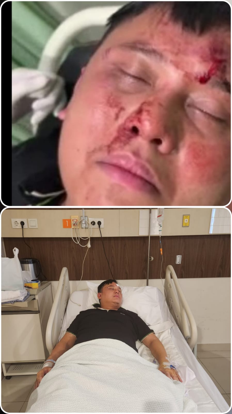 Diduga Melakukan Penganiayaan dan Penyekapan, Dedy Gunawan Laporkan Hendra Koh Owner Hiburan Club Malam Amavi ke Polda Sumut