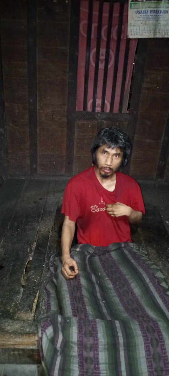 Warga Huta Namale Madina Dipasung 25 Tahun, Keluarga Minta Perhatian Dinas Kesehatan Sumut