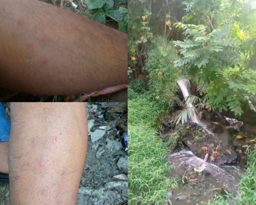 Diduga Limbah PTPN III Gunung Para Dolok Merawan Cemari Sungai Bahilang, Warga Terserang Penyakit Gatal