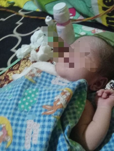Diduga Bayi Alami Patah Tulang Saat Persalinan di Puskesmas Binanga, Keluarga Kecewa, Aktivis Desak Investigasi